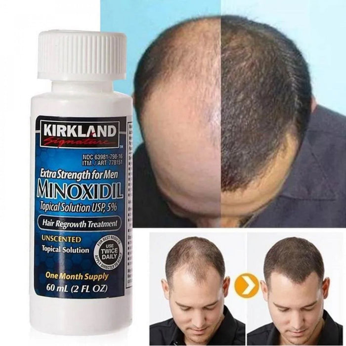 Minoxidil 5% Soch va Soqol O'stiruvchi