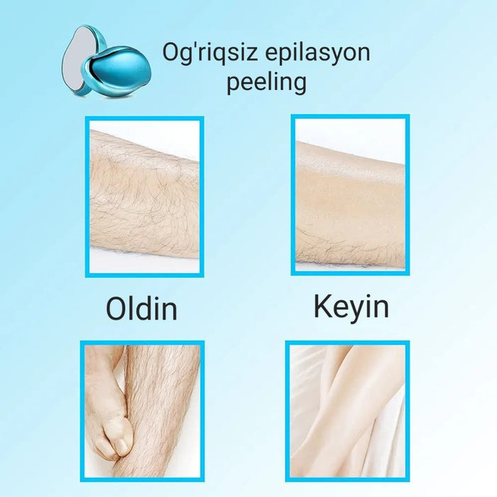 Epilatör Peeling